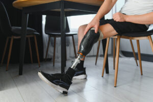 prosthetic