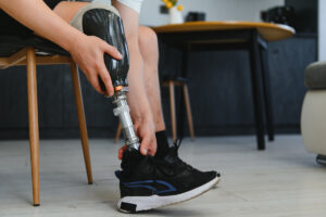 prosthetic leg