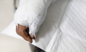 Patient receiving treatment for a burn injury in a hospital setting